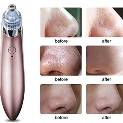 جهاز ازالة البثور السوداء Dobet Facial Pores Cleaner Blackhead Removal